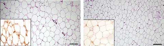 fat tissue cells