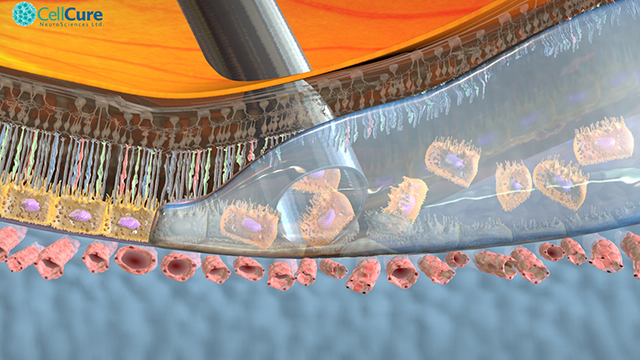 OpRegen Injection into Degerating Retina