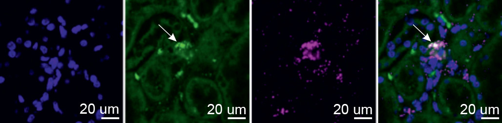 Decades Old Mystery Of Red Blood Cell 2