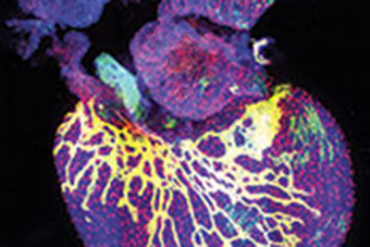 Rethinking Lymphatic Development