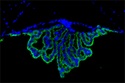 Choroid Plexus