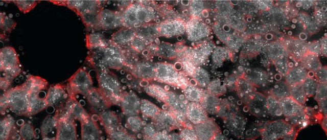 cross-section of a mouse liver lobule