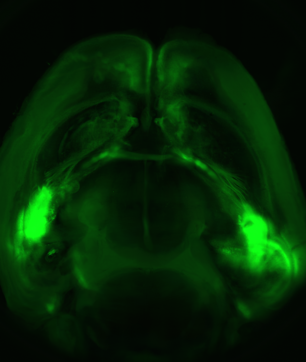 Turning Down the Brain to Erase Fearful Memories