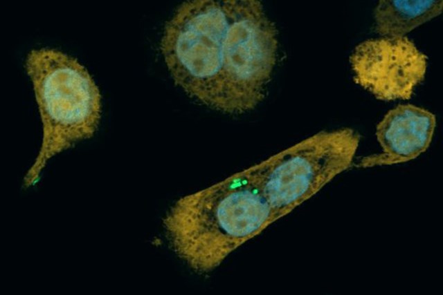 Bacteria in pancreatic cancer cell