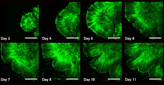 Organoids