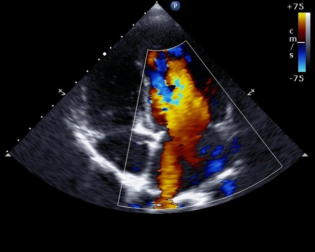 Electrocardiogram