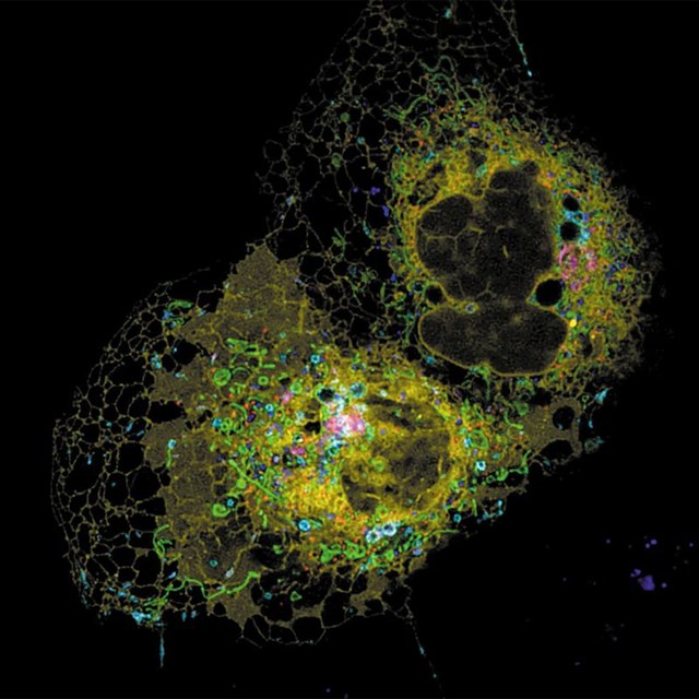 Endoplasmic Reticulum