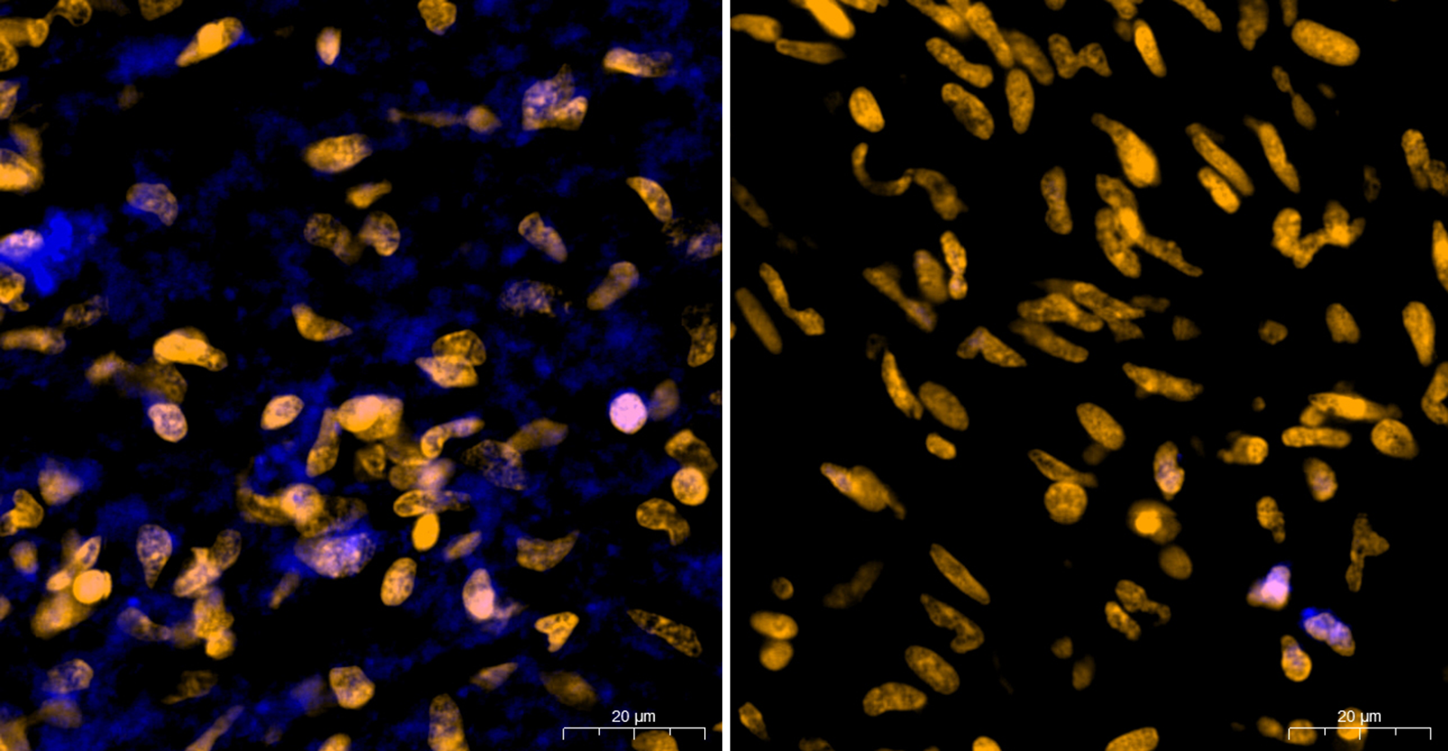 Bacteria On The Brain 4