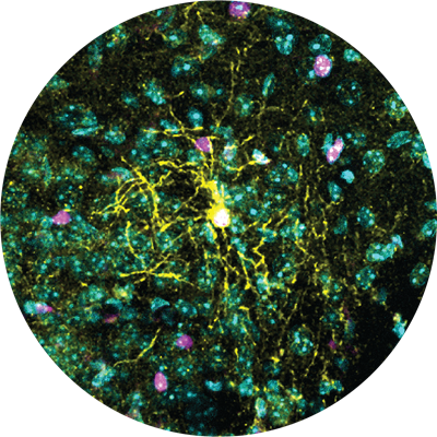 Brain Cells Of Males And Females Respond Differently To Chronic Stress 2