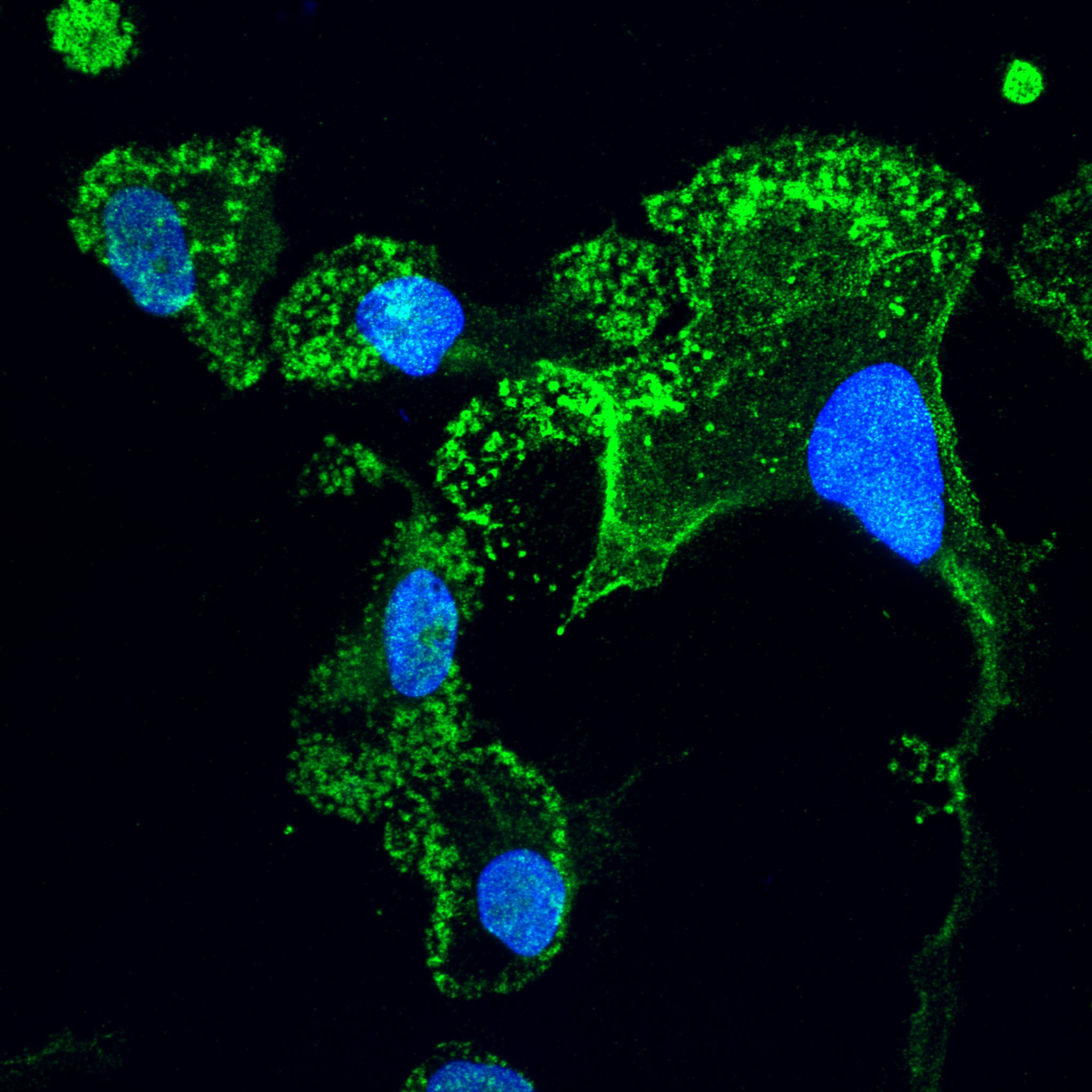 Mutations in Noncoding DNA Protect the Brain from ALS