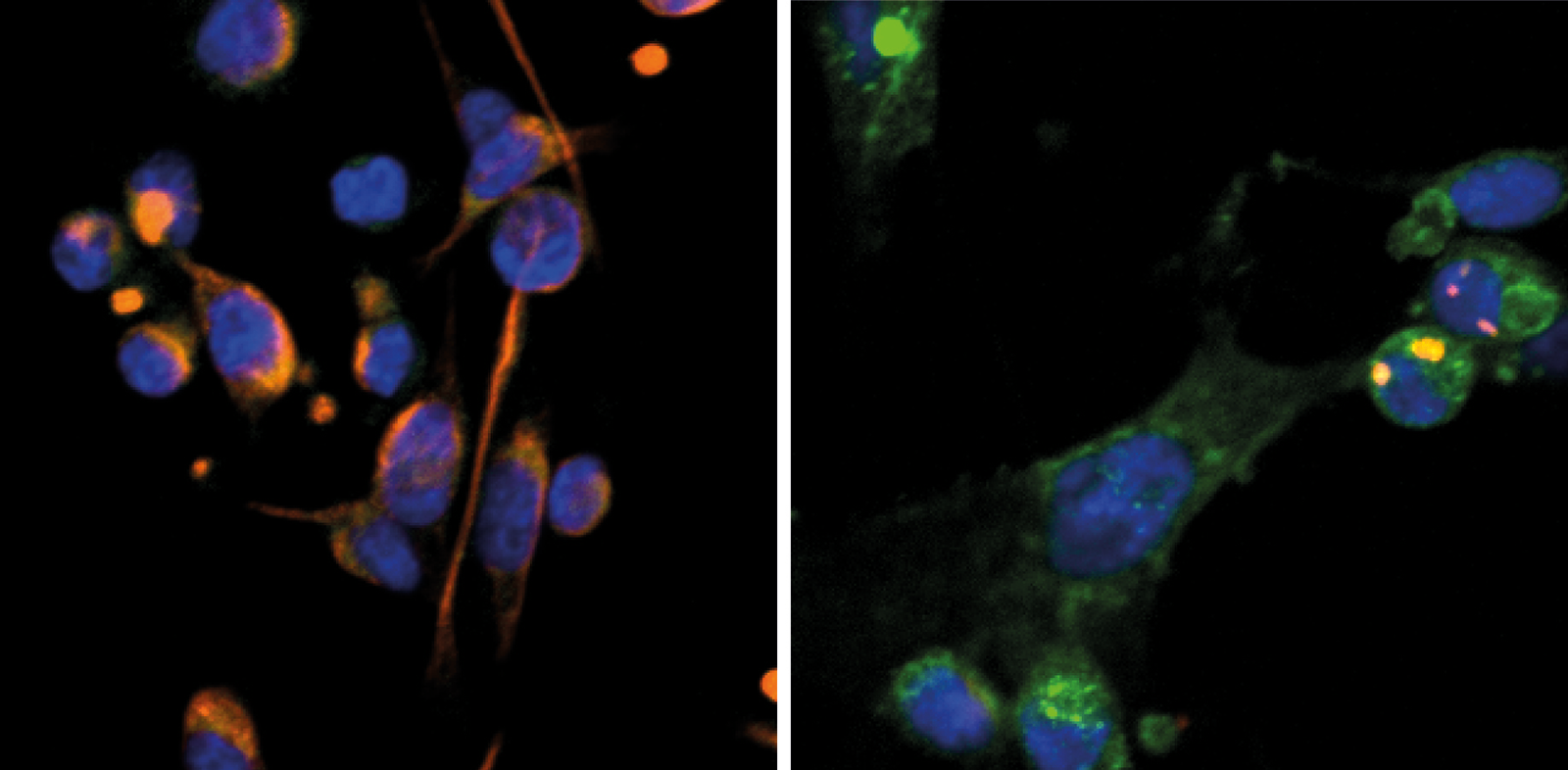 Wake Up Call For Dormant Cancer 3