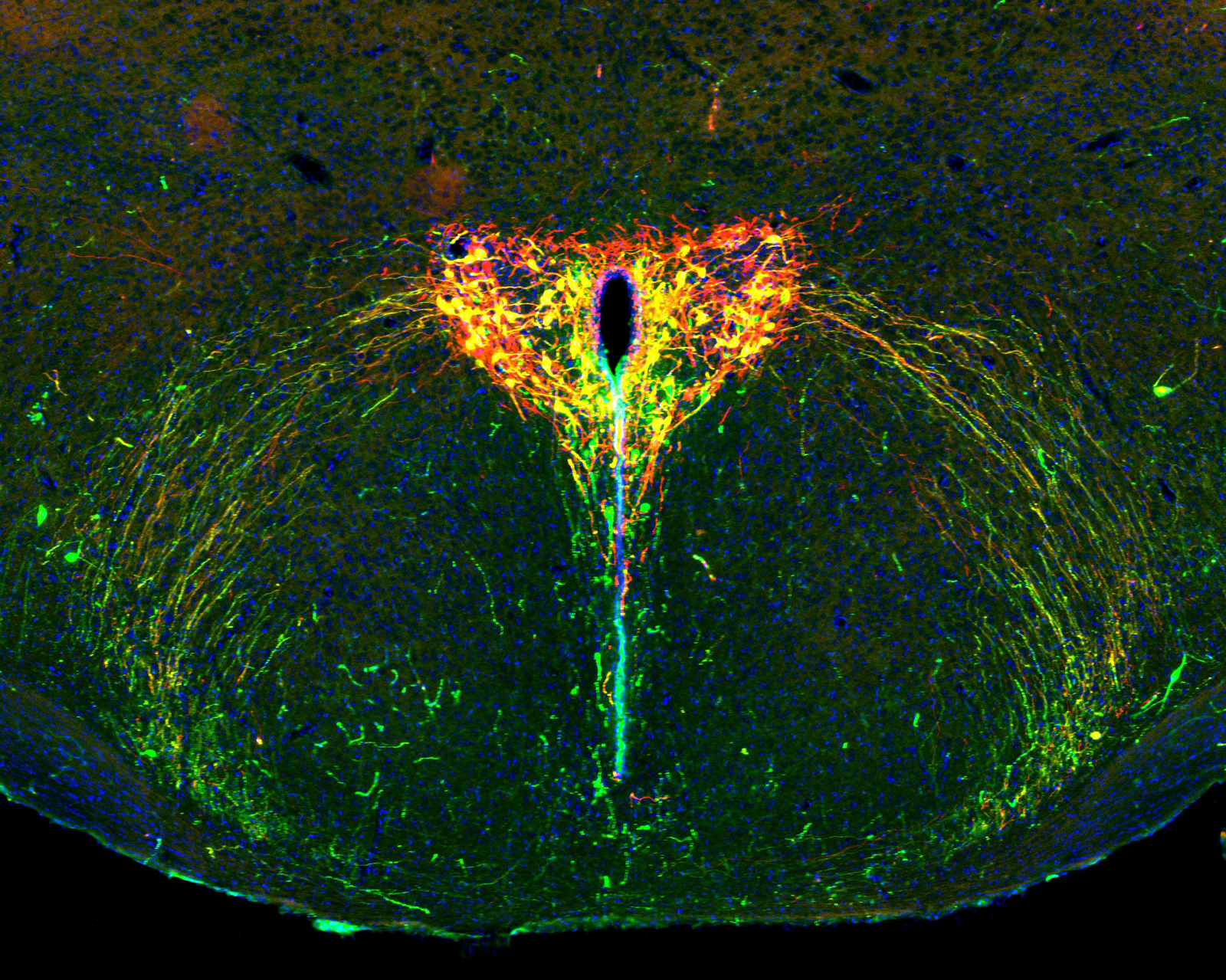 9.17.25 Shining A Light On The Developing Brain How Parental Separation Shapes Us Weizmann Institute Of Science 2