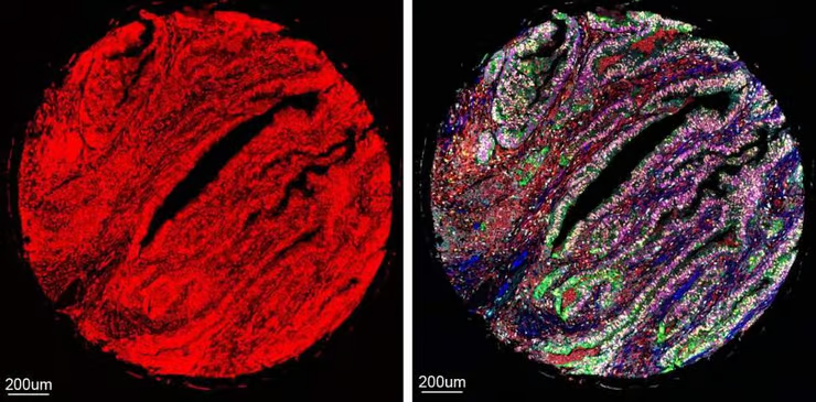 AI Revolutionizes Tissue Research